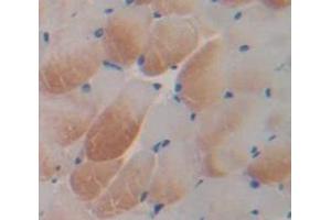 Immunohistochemistry (IHC) image for anti-Arachidonate 5-Lipoxygenase (ALOX5) (AA 223-410) antibody (ABIN1857967)