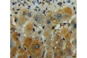 Used in DAB staining on fromalin fixed paraffin-embedded Liver tissue (DGKG 抗体  (AA 451-698))
