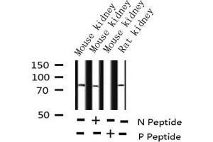 Western blot analysis of Phospho-C-RAF (Ser338) expression in various lysates (RAF1 抗体  (pSer338))