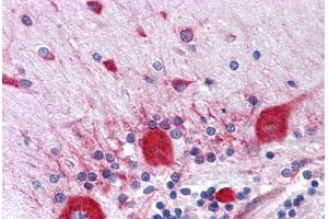 Human Brain, Cerebellum: Formalin-Fixed, Paraffin-Embedded (FFPE) (RPS2 抗体  (AA 198-294))