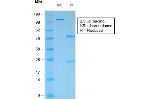 SDS-PAGE Analysis Purified Multi-Cytokeratin Rabbit Monoclonal Antibody (KRT/1877R). (Recombinant Cytokeratin, Multi (Epithelial Marker) 抗体)