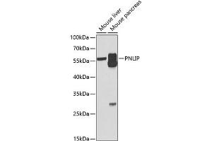 Western blot analysis of extracts of various cell lines, using PNLIP antibody (ABIN6128521, ABIN6145838, ABIN6145840 and ABIN6222025) at 1:1000 dilution. (PNLIP 抗体  (AA 166-465))