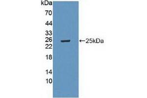 Western blot analysis of recombinant Mouse LAMa4. (LAMa4 抗体  (AA 745-940))