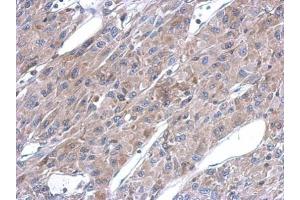 IHC-P Image Immunohistochemical analysis of paraffin-embedded U87 xenograft, using ASL, antibody at 1:500 dilution. (ASL 抗体)