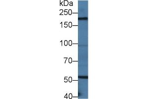 Detection of LAMb2 in Mouse Small intestine lysate using Polyclonal Antibody to Laminin Beta 2 (LAMb2) (LAMB2 抗体  (AA 1498-1716))
