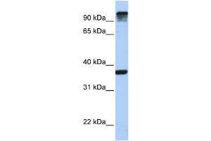 WB Suggested Anti-EPS15  Antibody Titration: 0. (EPS15 抗体  (C-Term))