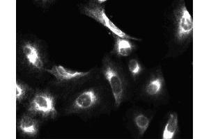 Immunofluorescent staining of A549 (ATCC CCL-185) cells. (PIK3CA 抗体  (AA 562-724))
