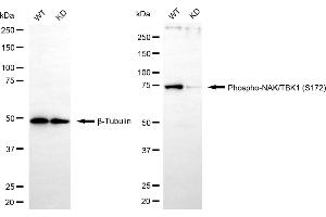 Western blotting analysis using phospho-NAK/TBK1 (S172) antibody (ABIN7800504). (Recombinant TBK1 抗体  (pSer172))