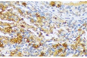 Immunohistochemistry of paraffin-embedded Rat ovary using A1CF Polyclonal Antibody at dilution of 1:100 (40x lens). (A1CF 抗体)