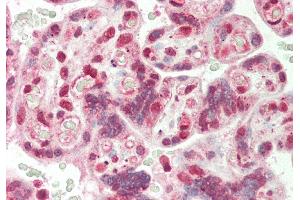 Rabbit Anti-CBX3 antibody  Formalin Fixed Paraffin Embedded Tissue: Human Placenta Primary antibody Concentration: 1:100 Secondary Antibody: Donkey anti-Rabbit-Cy3 Secondary Antibody Concentration: 1:200 Magnification: 20x Exposure Time: 0. (CBX3 抗体  (Middle Region))