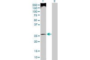 Lane 1: UBE2U transfected lysate ( 26. (UBE2U 293T Cell Transient Overexpression Lysate(Denatured))