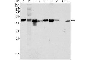 Western blot analysis using CK18 mouse mAb against Hela (1), NIH/3T3 (2), A549 (3), Jurkat (4), MCF-7(5), HepG2 (6), A431 (7), HEK293 (8) and K562 (9) cell lysate. (Cytokeratin 18 抗体  (AA 391-483))