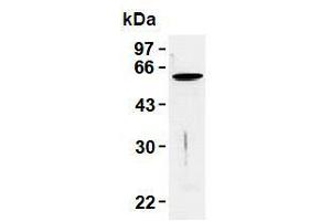 Western Blotting (WB) image for anti-Vimentin (VIM) antibody (ABIN1109486) (Vimentin 抗体)