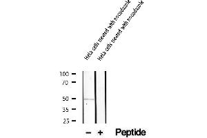 Western blot analysis of extracts of HeLa cells treated with nocodazole , using Phospho-Keratin 17 (Ser44) Antibody.