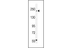 Western Blotting (WB) image for anti-Collagen, Type V, alpha 1 (COL5A1) (AA 54-82), (N-Term) antibody (ABIN654444)