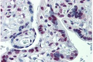 Human Placenta: Formalin-Fixed, Paraffin-Embedded (FFPE) (CUL9 抗体)