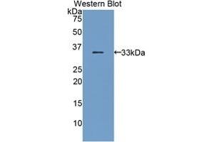 Detection of Recombinant BST1, Mouse using Polyclonal Antibody to Bone Marrow Stromal Cell Antigen 1 (BST1) (BST1 抗体  (AA 28-282))
