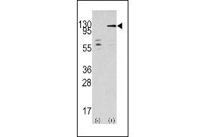 Western blot analysis of TAOK3 (arrow) using rabbit polyclonal TAOK3 Antibody (C-term) (ABIN390997 and ABIN2841175). (TAO Kinase 3 抗体  (C-Term))