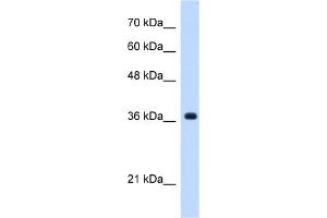 WB Suggested Anti-C19orf47 Antibody Titration:  0. (C19orf47 抗体  (C-Term))