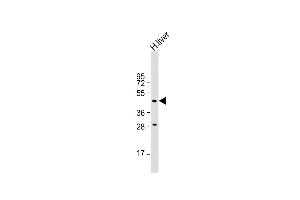 MMAA 抗体  (N-Term)