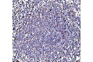 IHC analysis of PMPCA/INPP5 using anti-PMPCA/INPP5 antibody (ABIN7602722). (PMPCA 抗体  (AA 99-525))
