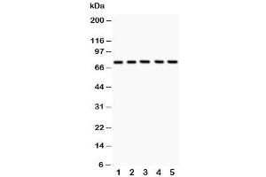 Western blot testing of 12 Lipoxygenase antibody and Lane 1:  A549 (12-Lipoxygenase 抗体  (C-Term))