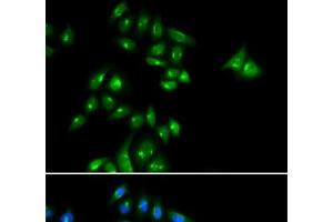 Immunofluorescence analysis of U2OS cells using PHC3 Polyclonal Antibody
