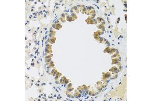 Immunohistochemistry of paraffin-embedded mouse lung using CRTAP antibody (ABIN5972488) at dilution of 1/100 (40x lens). (CRTAP 抗体)