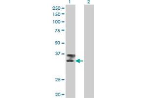 Western Blotting (WB) image for anti-Titin (TTN) (AA 1-111) antibody (ABIN598991) (Titin 抗体  (AA 1-111))
