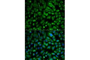 Immunofluorescence analysis of MCF7 cells using eIF4E antibody . (EIF4E 抗体  (AA 1-217))