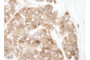 Immunohistochemistry (IHC) image for anti-Apoptosis-Inducing Factor, Mitochondrion-Associated, 1 (AIFM1) (AA 100-150) antibody (ABIN7453653)