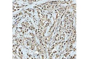IHC analysis of DCK using anti-DCK antibody (ABIN5693016).