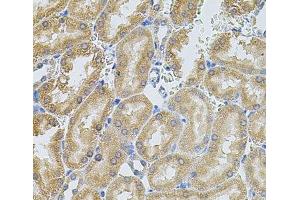 Immunohistochemistry of paraffin-embedded Rat kidney using MMP10 Polyclonal Antibody at dilution of 1:100 (40x lens). (MMP10 抗体)