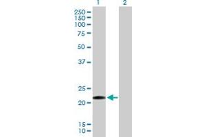 Western Blot analysis of CLEC1B expression in transfected 293T cell line by CLEC1B MaxPab polyclonal antibody. (C-Type Lectin Domain Family 1, Member B (CLEC1B) (AA 1-196) 抗体)