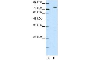 WB Suggested Anti-MYST2  Antibody Titration: 0. (MYST2 抗体  (N-Term))