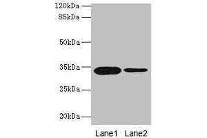 Western blot All lanes: OGN antibody at 14 μg/mL Lane 1: Rat liver tissue Lane 2: 293T whole cell lysate Secondary Goat polyclonal to rabbit IgG at 1/10000 dilution Predicted band size: 34 kDa Observed band size: 34 kDa (OGN 抗体  (AA 21-298))