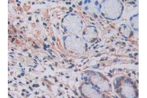 Immunohistochemistry (IHC) image for anti-Lysyl Oxidase-Like 2 (LOXL2) (AA 544-751) antibody (ABIN7438565)