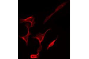 ABIN6267269 staining SK-OV3 by IF/ICC. (EGFR 抗体  (pSer1071))