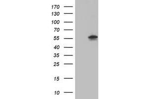 HEK293T cells were transfected with the pCMV6-ENTRY control (Left lane) or pCMV6-ENTRY AKT1 (Right lane) cDNA for 48 hrs and lysed. (AKT1 抗体)