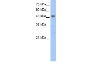 RSAD2 antibody used at 5 ug/ml to detect target protein. (RSAD2 抗体  (C-Term))
