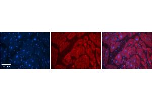 Rabbit Anti-SLC6A5 Antibody    Formalin Fixed Paraffin Embedded Tissue: Human Adult heart  Observed Staining: Cytoplasmic Primary Antibody Concentration: 1:600 Secondary Antibody: Donkey anti-Rabbit-Cy2/3 Secondary Antibody Concentration: 1:200 Magnification: 20X Exposure Time: 0. (SLC6A5 抗体  (N-Term))