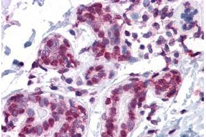 Immunohistochemistry (Formalin-fixed Paraffin-embedded Sections) (IHC (fp)) image for anti-Glucocorticoid Modulatory Element Binding Protein 1 (GMEB1) (AA 467-564) antibody (ABIN574422)