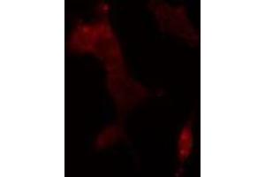 ABIN6275650 staining  293 cells by IF/ICC. (USP11 抗体  (Internal Region))