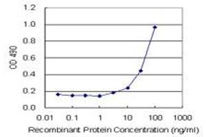 ELISA image for B2M (Human) Matched Antibody Pair (ABIN1340811)