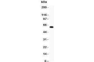 Western blot testing of DR3 antbody and COLO320 lysate. (DR3/LARD 抗体  (N-Term))