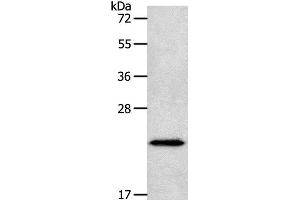 Western Blot analysis of Human liver cancer tissue using NEUROG1 Polyclonal Antibody at dilution of 1:400 (Neurogenin 1 抗体)