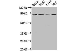 Western Blot Positive WB detected in: Hela whole cell lysate, U251 whole cell lysate, A549 whole cell lysate, U87 whole cell lysate All lanes: VPS51 antibody at 1:1000 Secondary Goat polyclonal to rabbit IgG at 1/50000 dilution Predicted band size: 87, 73 kDa Observed band size: 87 kDa (VPS51 抗体  (AA 595-673))