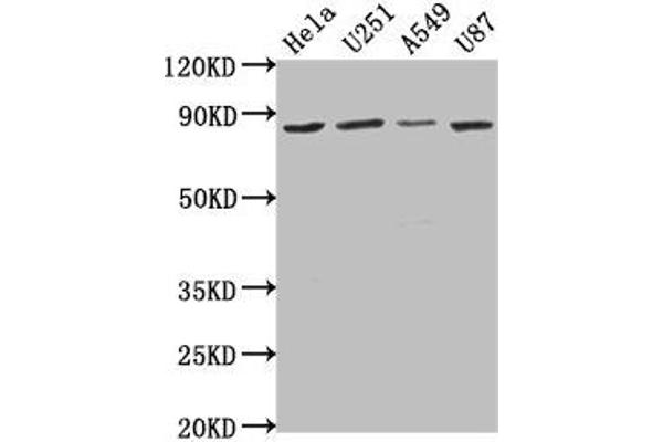 VPS51 抗体  (AA 595-673)