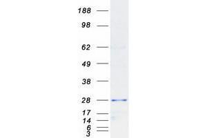 Validation with Western Blot