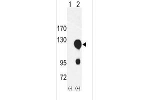 Western blot analysis of ROR2 using rabbit polyclonal ROR2 Antibody using 293 cell lysates (2 ug/lane) either nontransfected (Lane 1) or transiently transfected with the ROR2 gene (Lane 2). (ROR2 抗体  (N-Term))